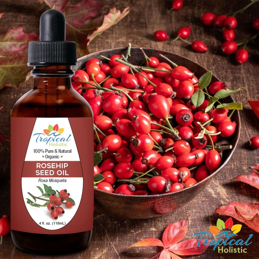 Rosehip Oil: The Ultimate Natural Anti -Aging Oil – Tropical Holistic