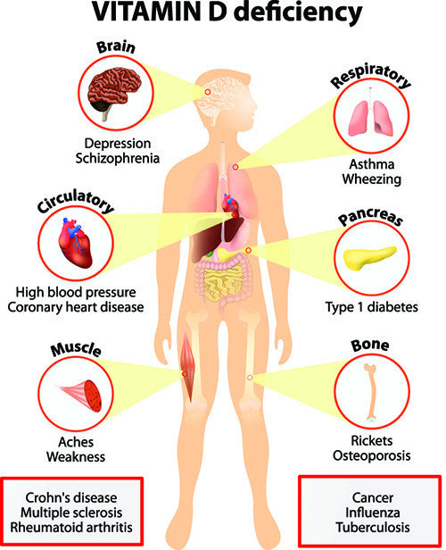 Are You Deficient in Vitamin D?